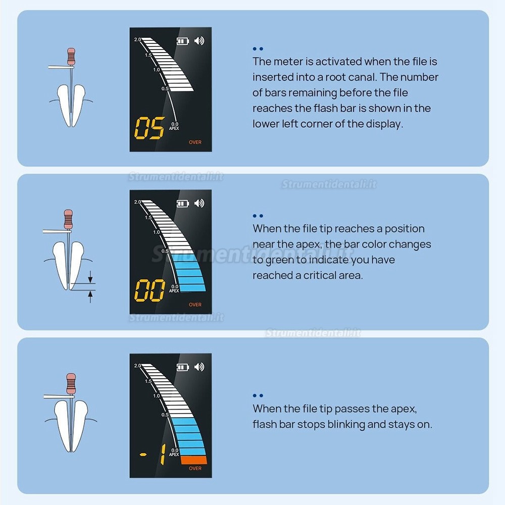 Rilevatore apicale endodonzia dente, localizzatore apicale endodonzia Micropex Pro