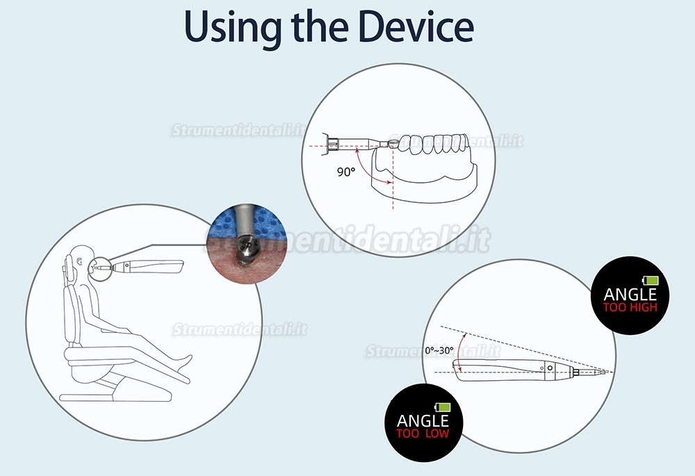 YAHOPE iCHECK ISQ misuratore stabilità implantare dispositivo di misurazione della stabilità dell'impianto