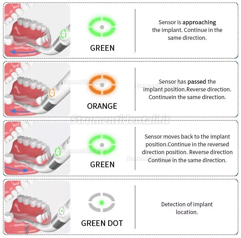 YAHOPE iD1 Localizzatore implantare Kit localizzatore di impianti dentali